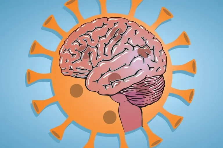 [해외 DS] 코로나19의 뇌 건강 영향, 7년간의 뇌 노화에 상응하는 인지 기능 저하 발생